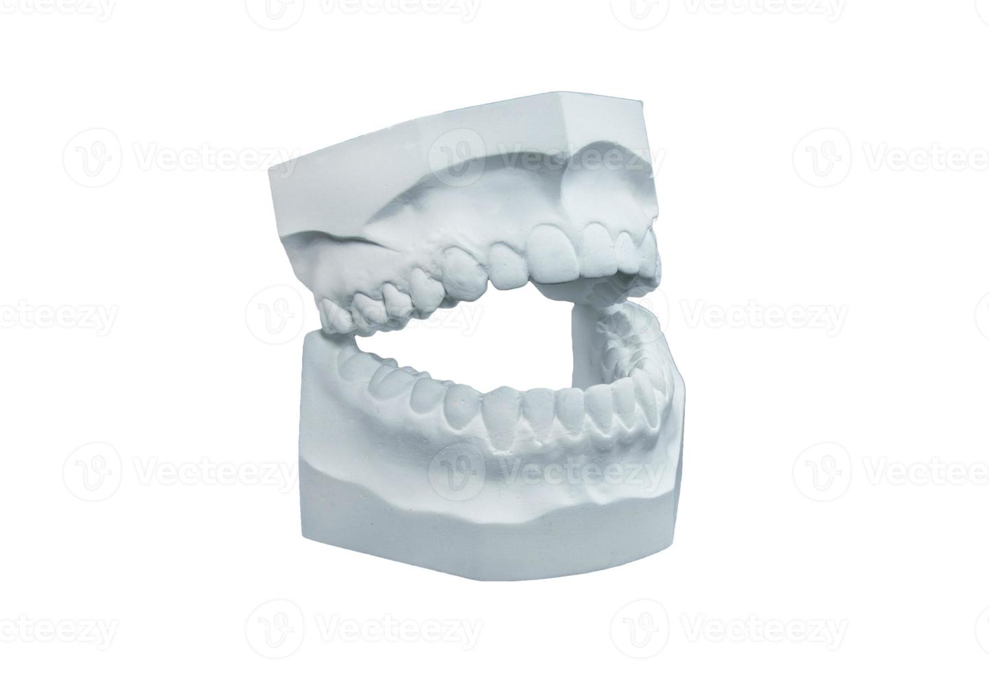 dental gesso fundida em branco fundo foto