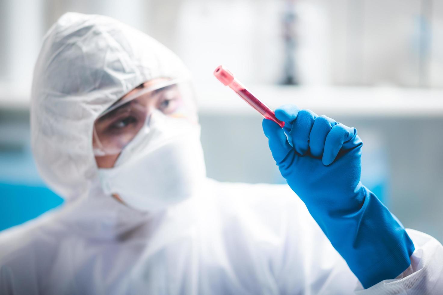 pesquisador segurando uma amostra de sangue foto