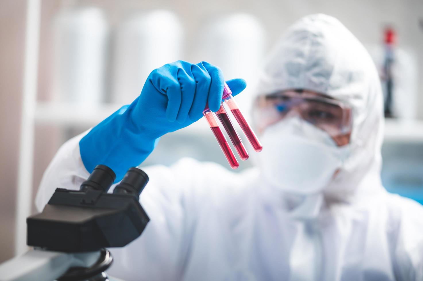 pesquisador segurando amostras de sangue foto