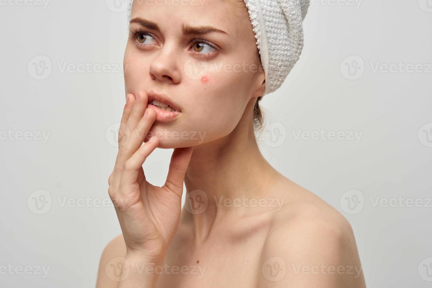 lindo mulher com uma espinha em a face dermatologia isolado fundo foto
