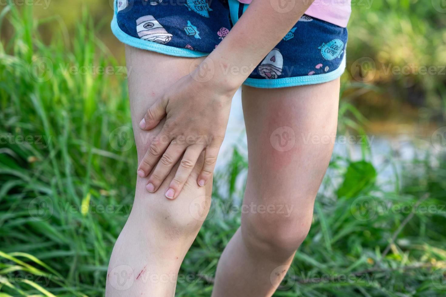 menina pulveriza spray de mosquito na pele na natureza que morde as mãos e os pés. proteção contra picadas de insetos, repelente seguro para crianças. recreação ao ar livre, contra alergias. horário de verão foto