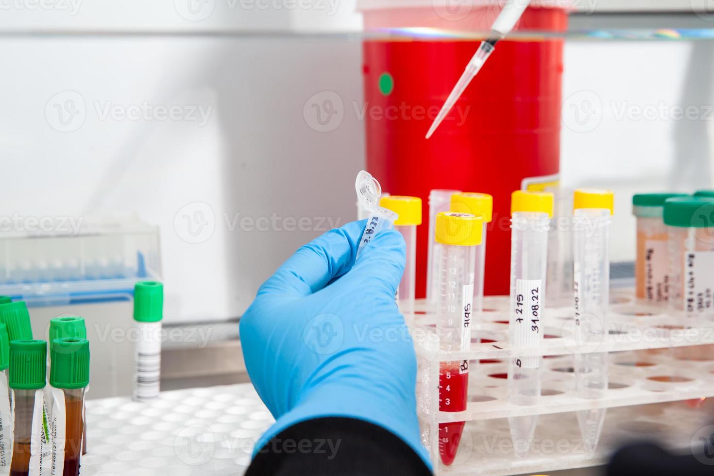 cientista preparando sangue amostras para cariótipo e fluorescência dentro local hibridização dentro a laminar ar fluxo gabinete. sangue amostra preparação para diagnóstico. sangue teste. foto
