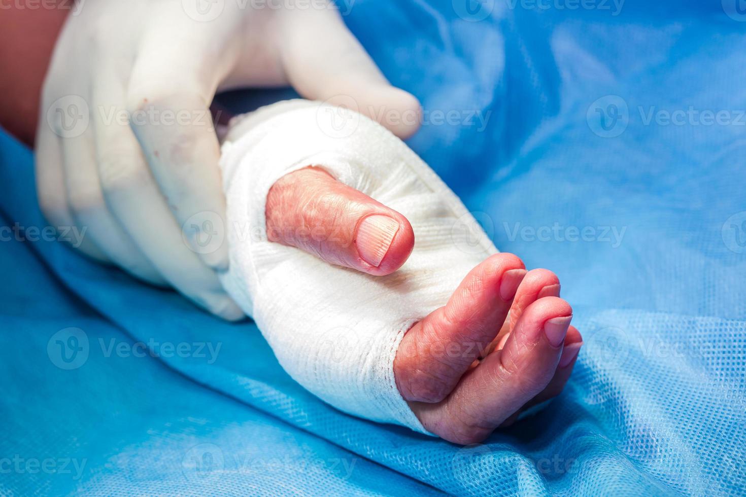 cirurgião bandagem a mão do uma paciente às a fim do cirurgia foto