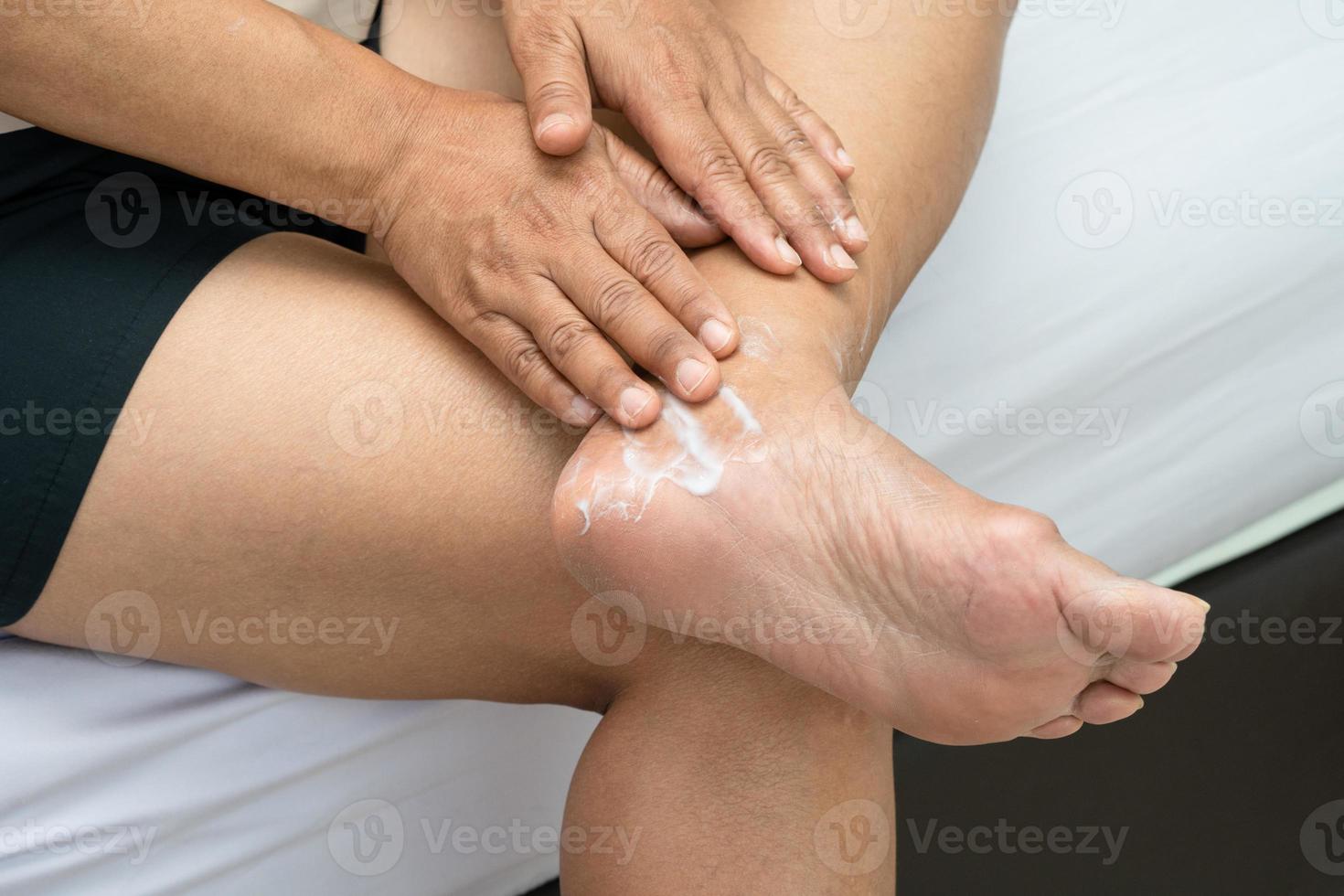 pés de cuidados de mulher com creme de pele de calcanhar rachado e seco em casa. foto
