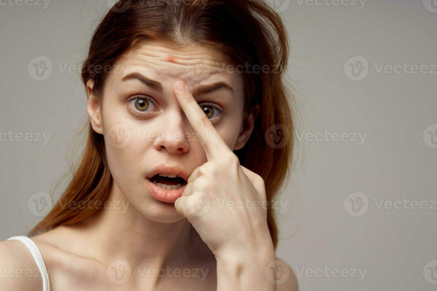 lindo mulher dentro uma branco camiseta espinhas em a face luz fundo foto