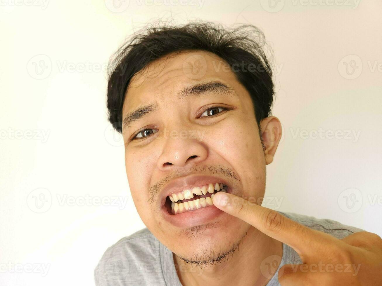 ásia homem apontando dele quebrado dente foto