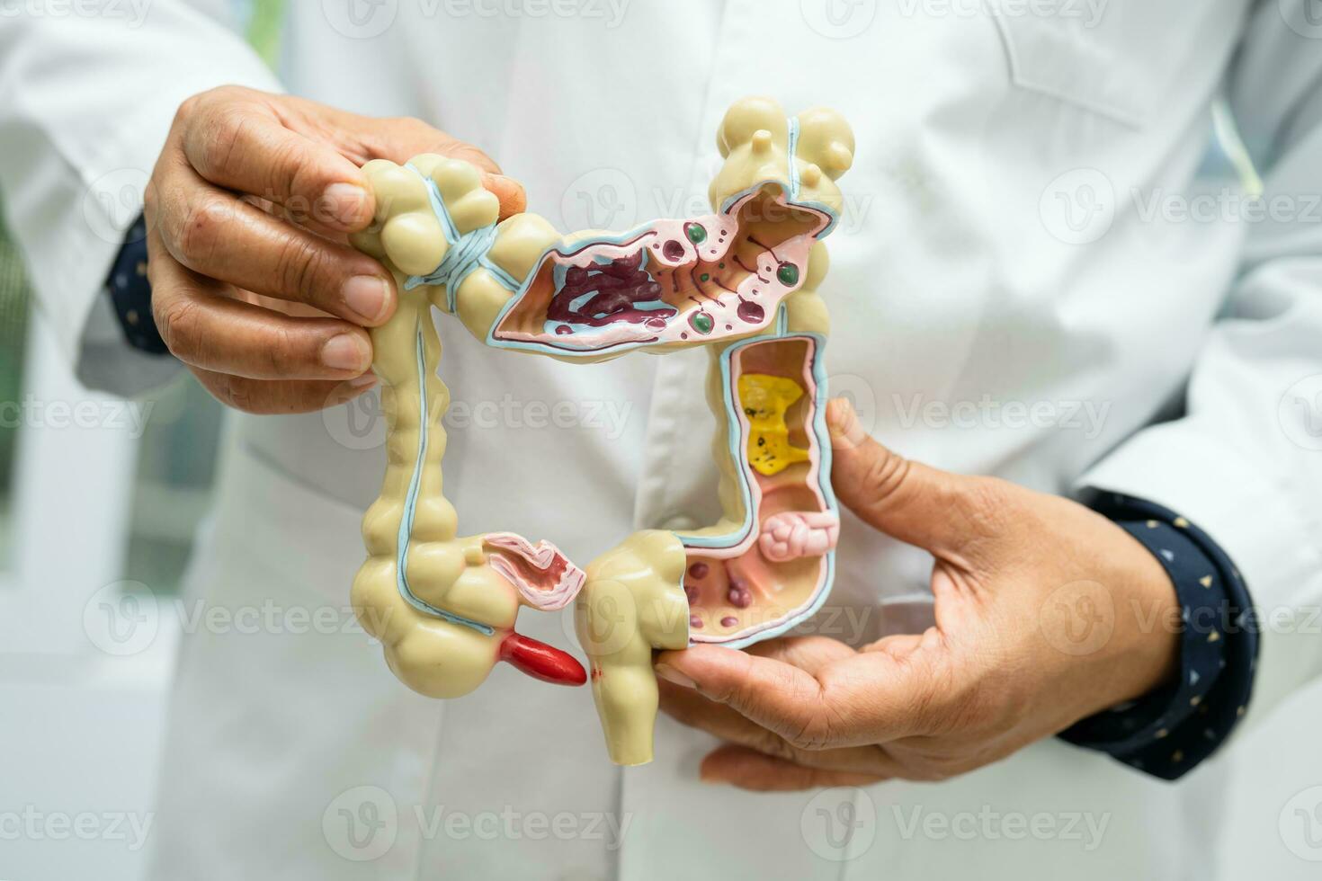 intestino, apêndice e digestivo sistema, médico segurando anatomia modelo para estude diagnóstico e tratamento dentro hospital. foto