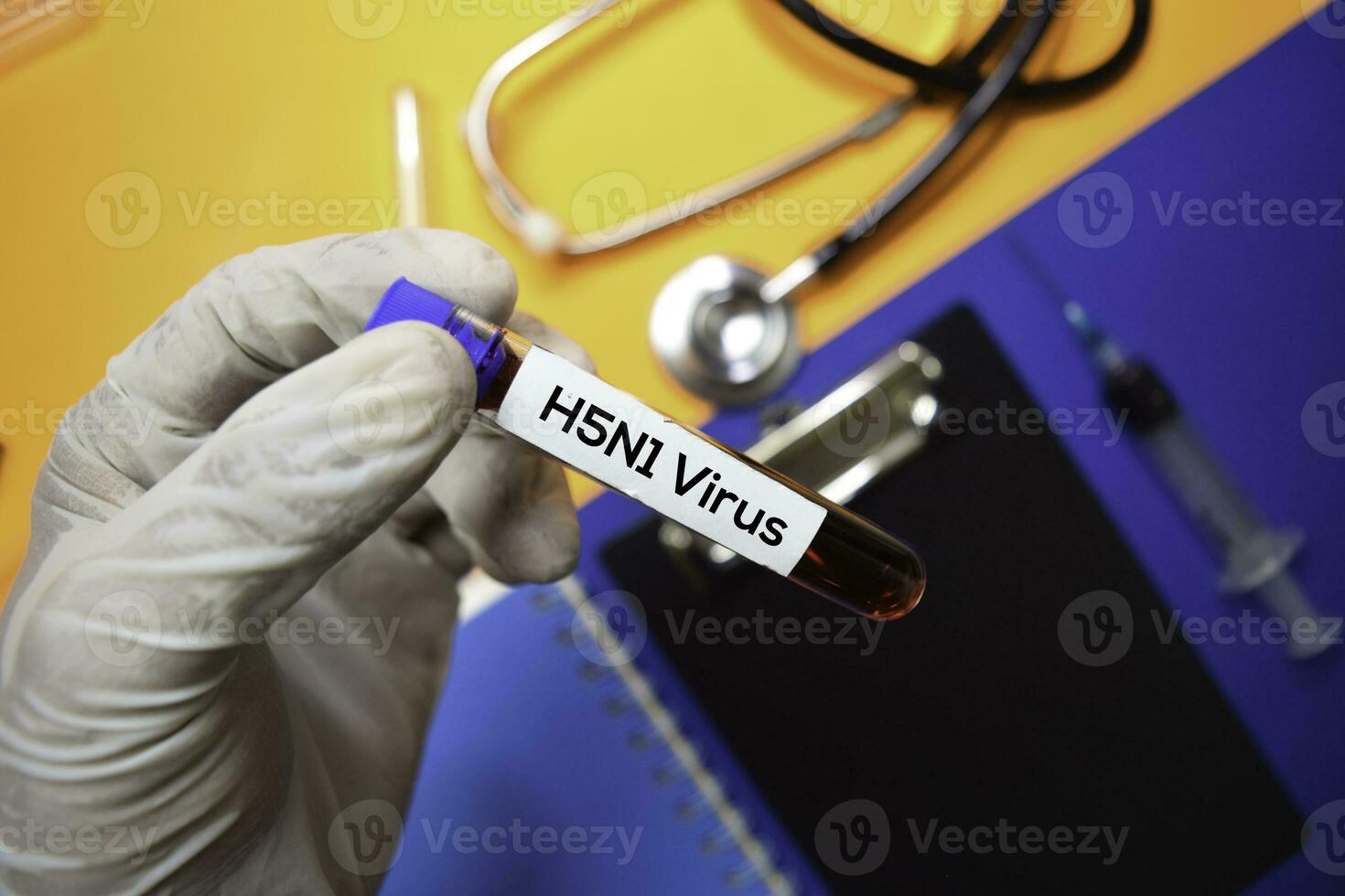h5n1 vírus com sangue amostra. topo Visão isolado em cor fundo. cuidados de saúde médico conceito foto