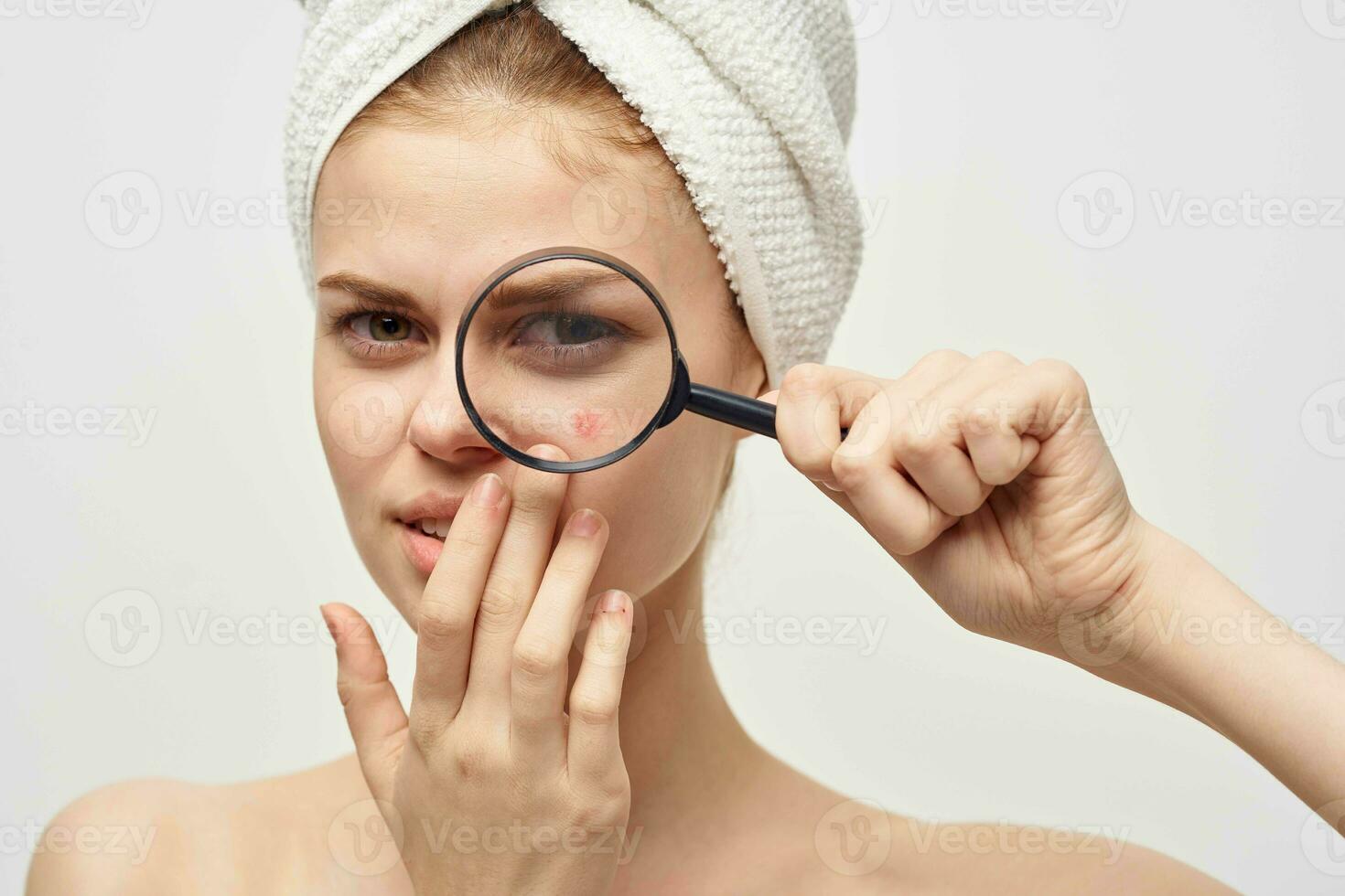 mulher com uma espinha em a face dermatologia isolado fundo foto