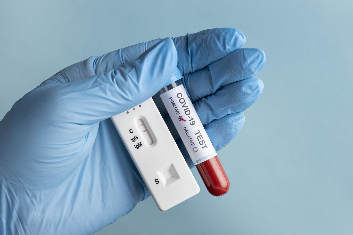 mão com luvas de proteção segurando uma amostra de sangue para teste cobiçado foto