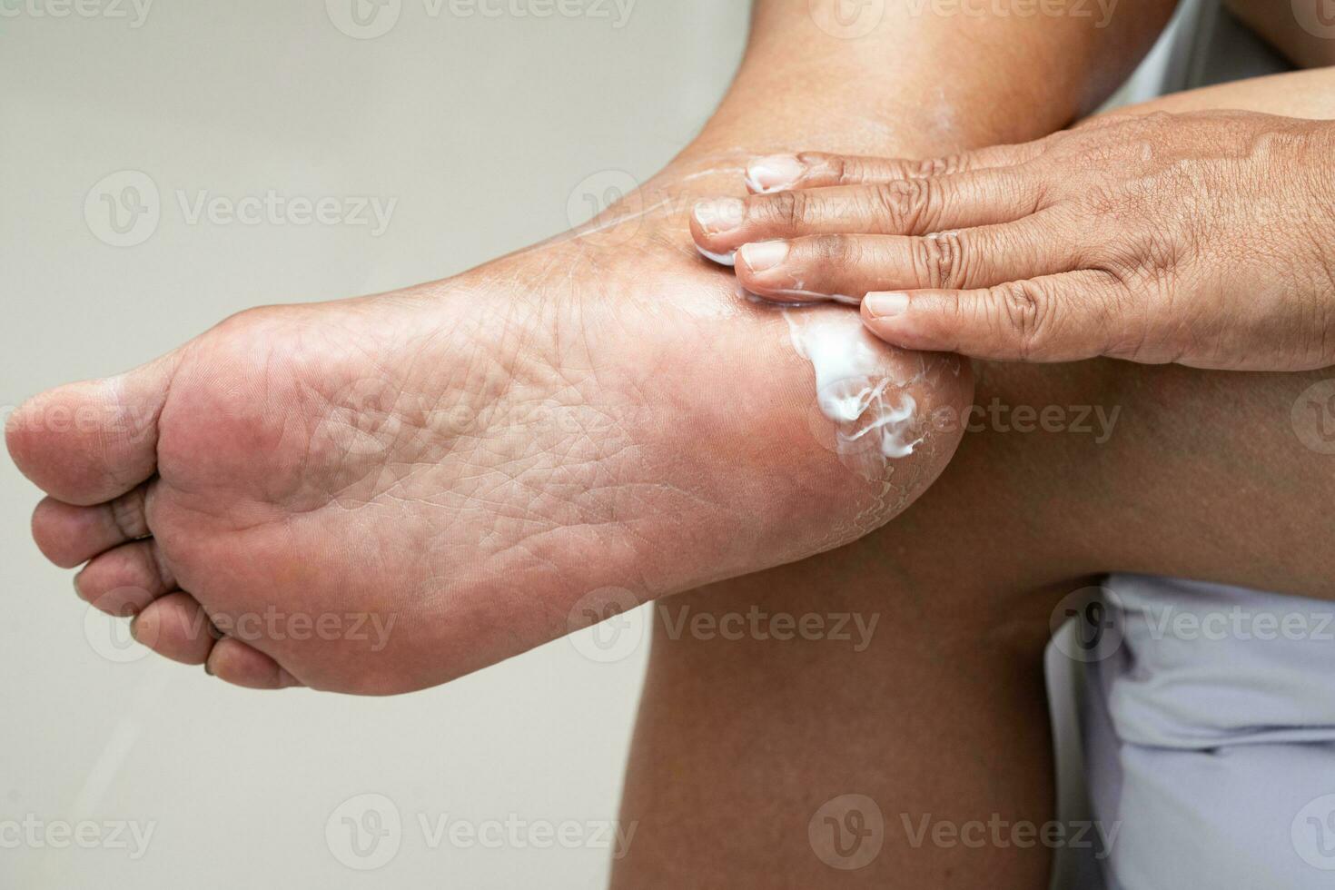 pés de cuidados de mulher com creme de pele de calcanhar rachado e seco em casa. foto