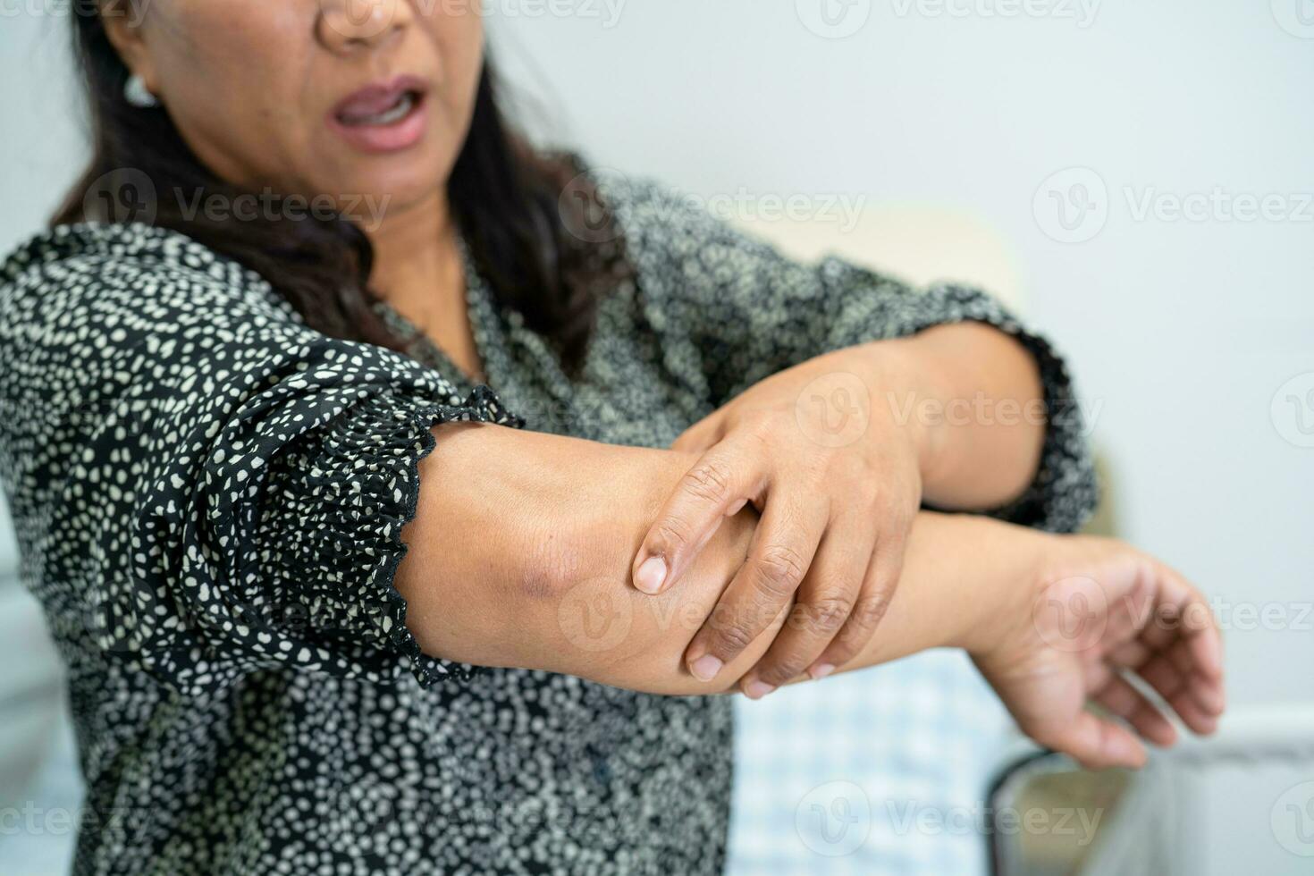 ásia mulher paciente toque e sentir dor dela cotovelo e braço, saudável médico conceito. foto