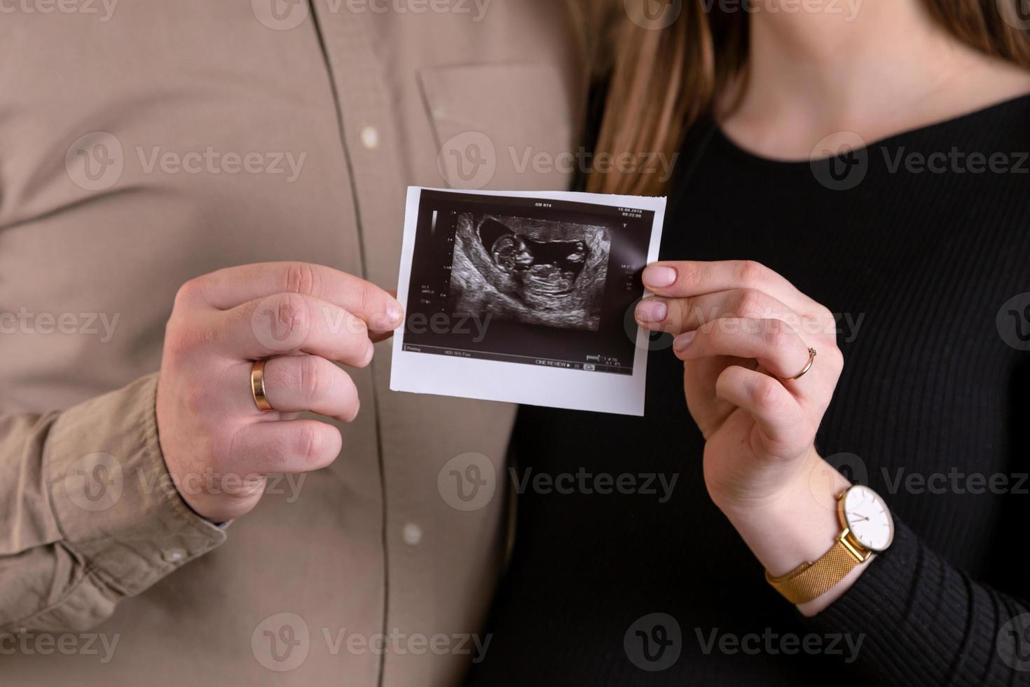 a expectativa de uma criança foto