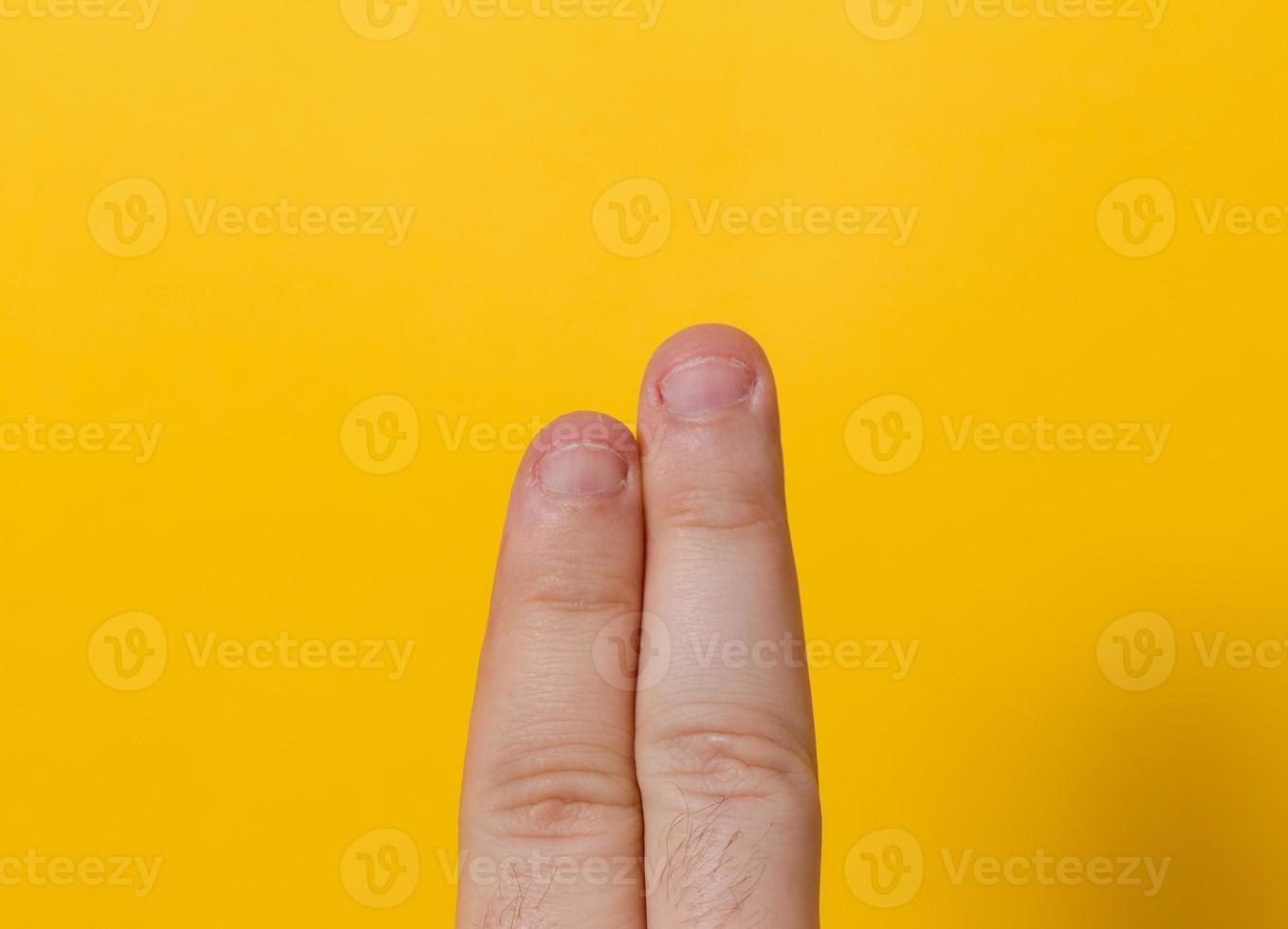 dedos com unhas roídas isoladas em um fundo amarelo foto