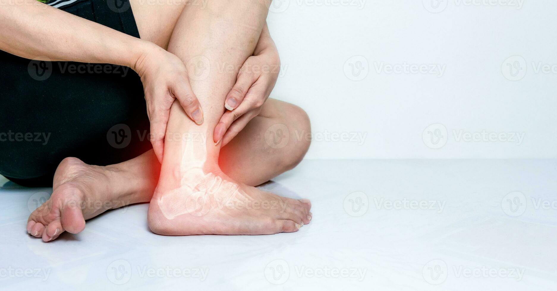 osso tornozelo juntas do humanos com inflamação foto