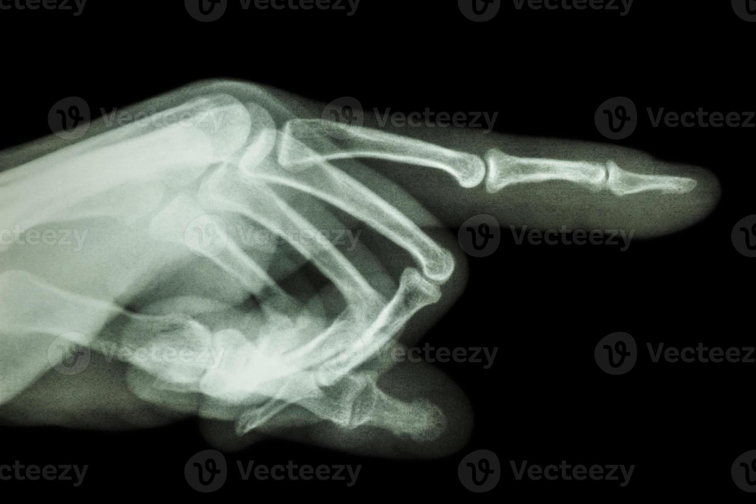 humano está apontando o dedo filme raio x foto