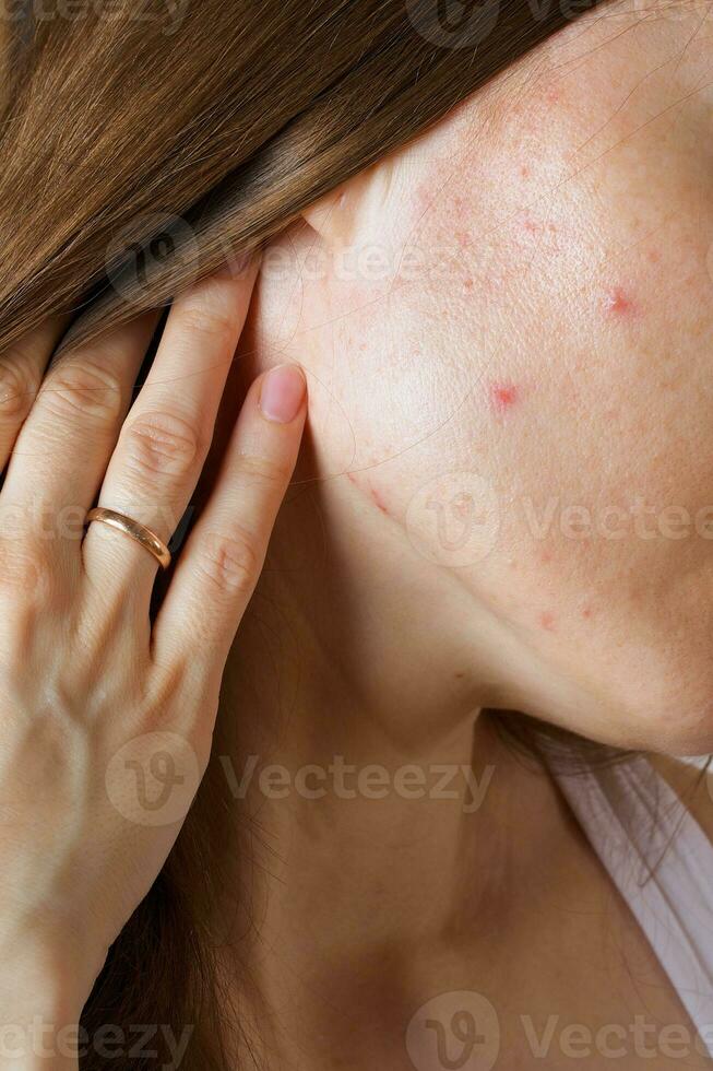 face pele do jovem senhora entre 30 e 35 anos velho. fechar-se foto