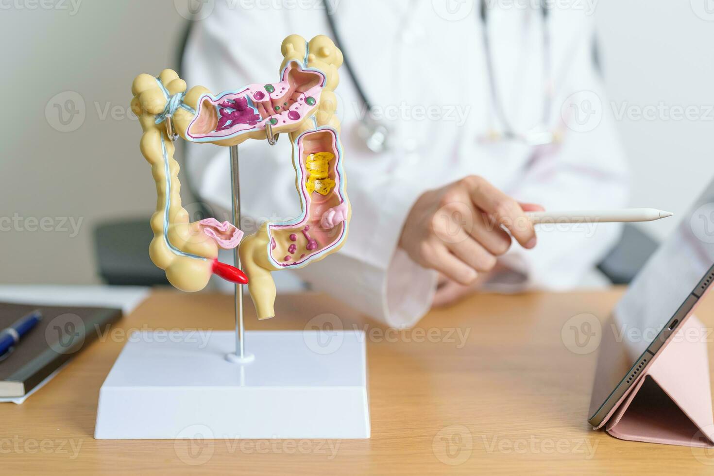 médico com humano cólon anatomia modelo e tábua. colônico doença, ampla intestino, colorretal Câncer, ulcerativo colite, diverticulite, irritável intestino síndrome e digestivo sistema foto