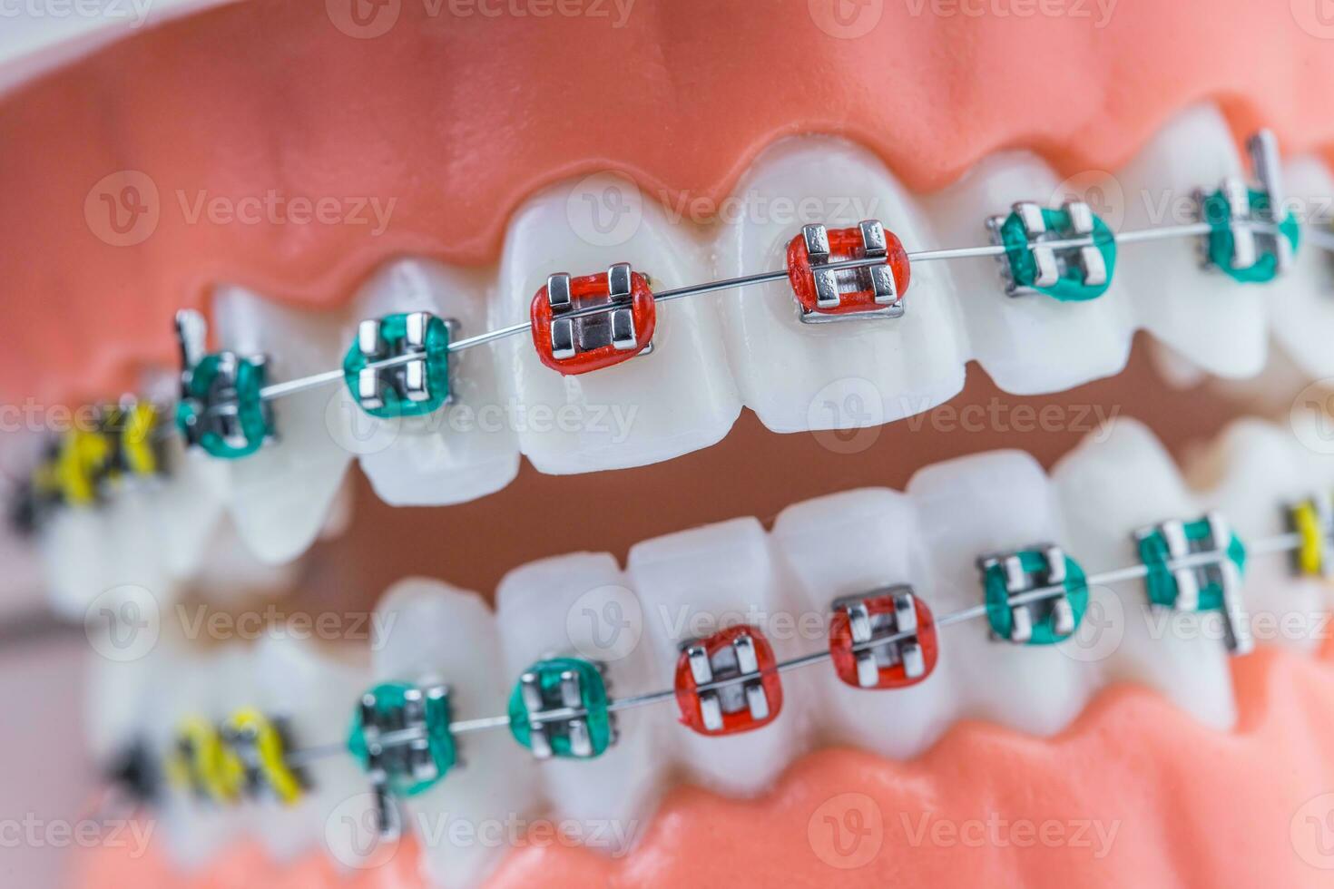fechar-se do uma ortodôntico modelo mandíbulas e dentes com suspensórios foto