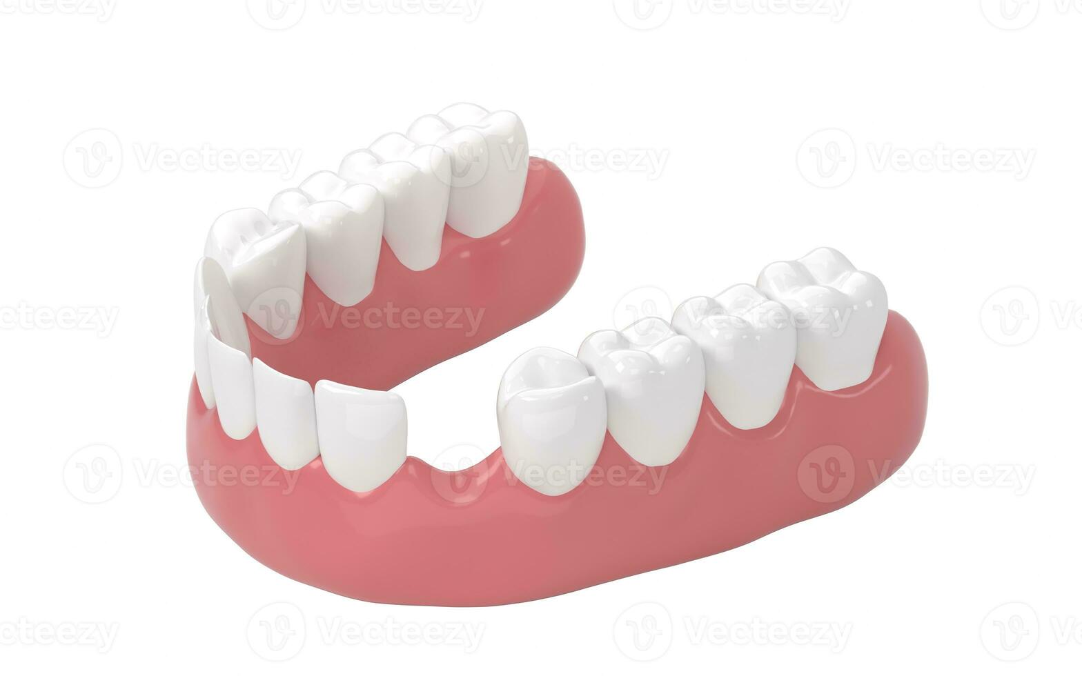 falta do dente, dentes tratamento, 3d Renderização. foto