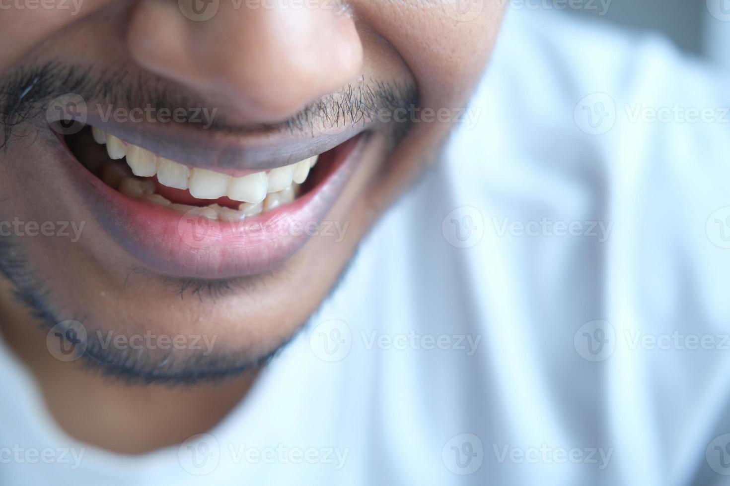 jovem homem aberto verificando os dentes foto