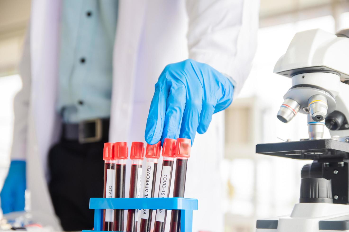 médico examina patógenos em amostras de sangue de covid19 pacientes foto