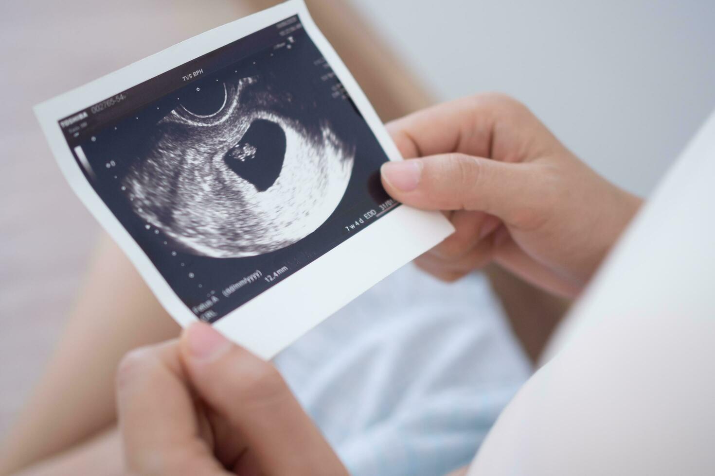 mulher grávida está olhando para uma foto de ultrassom do feto. mãe toca suavemente o bebê no estômago. feliz, família, crescimento, gravidez, prazer, preparar recém-nascido, cuidar, saúde, barriga.