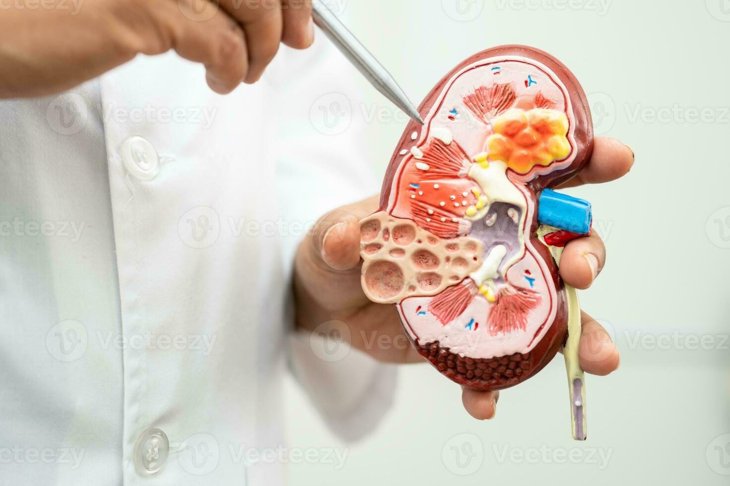 rim doença, crônica rim doença ckd, médico aguarde modelo para estude e tratar dentro hospital. foto