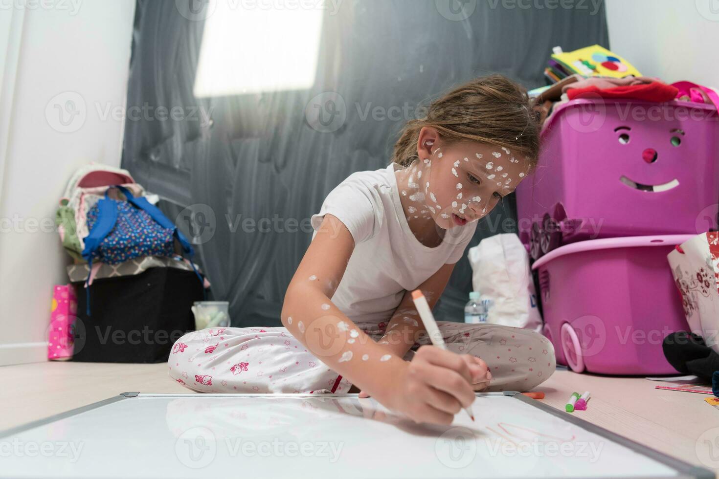 pequeno escola menina com catapora desenhando em branco borda dentro crianças' sala, antisséptico creme aplicado para face e corpo. quadro-negro e brinquedos fundo. foto