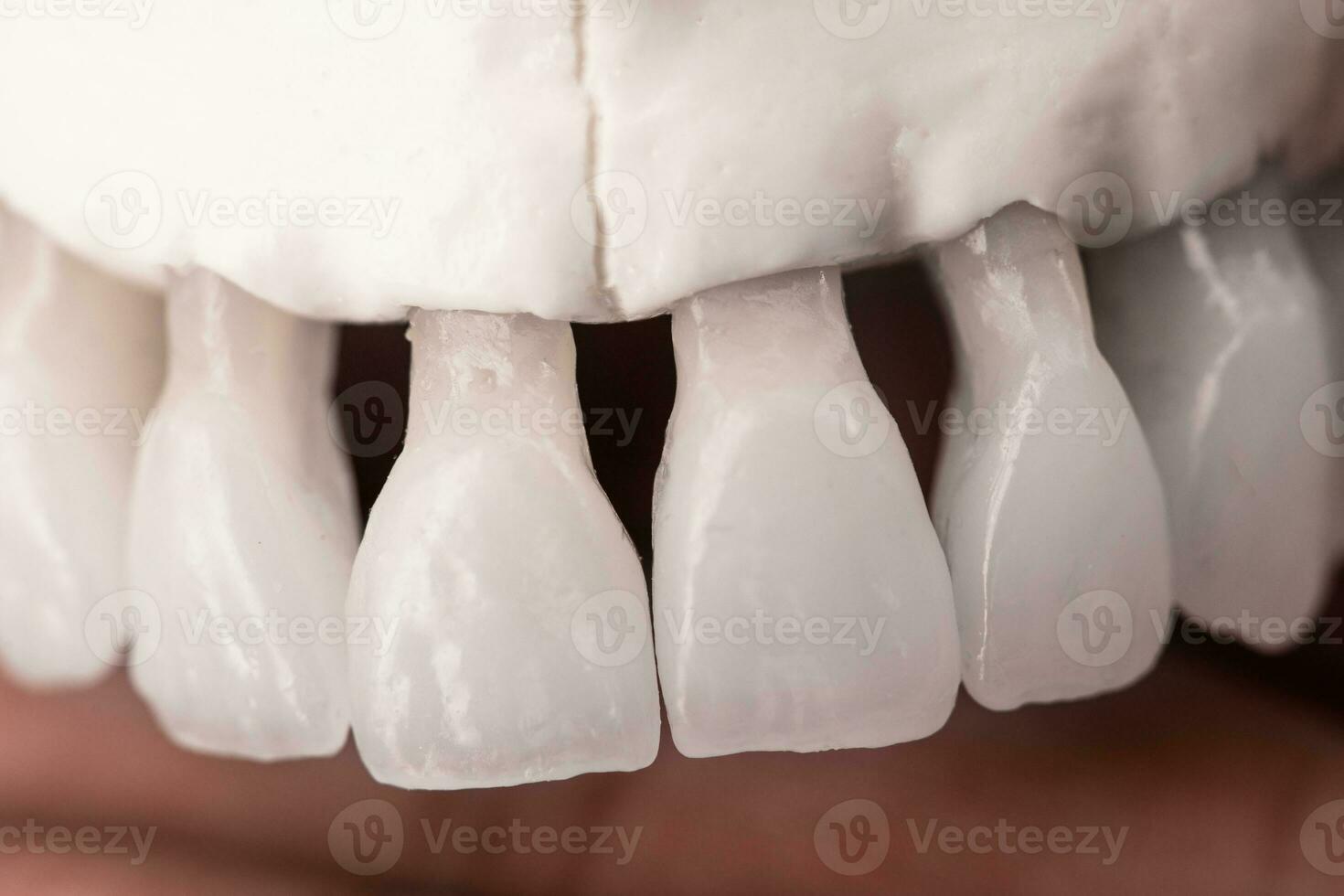 superior humano mandíbula com dentes anatomia modelo isolado em azul fundo. saudável dentes, dental Cuidado e ortodôntico médico conceito. foto