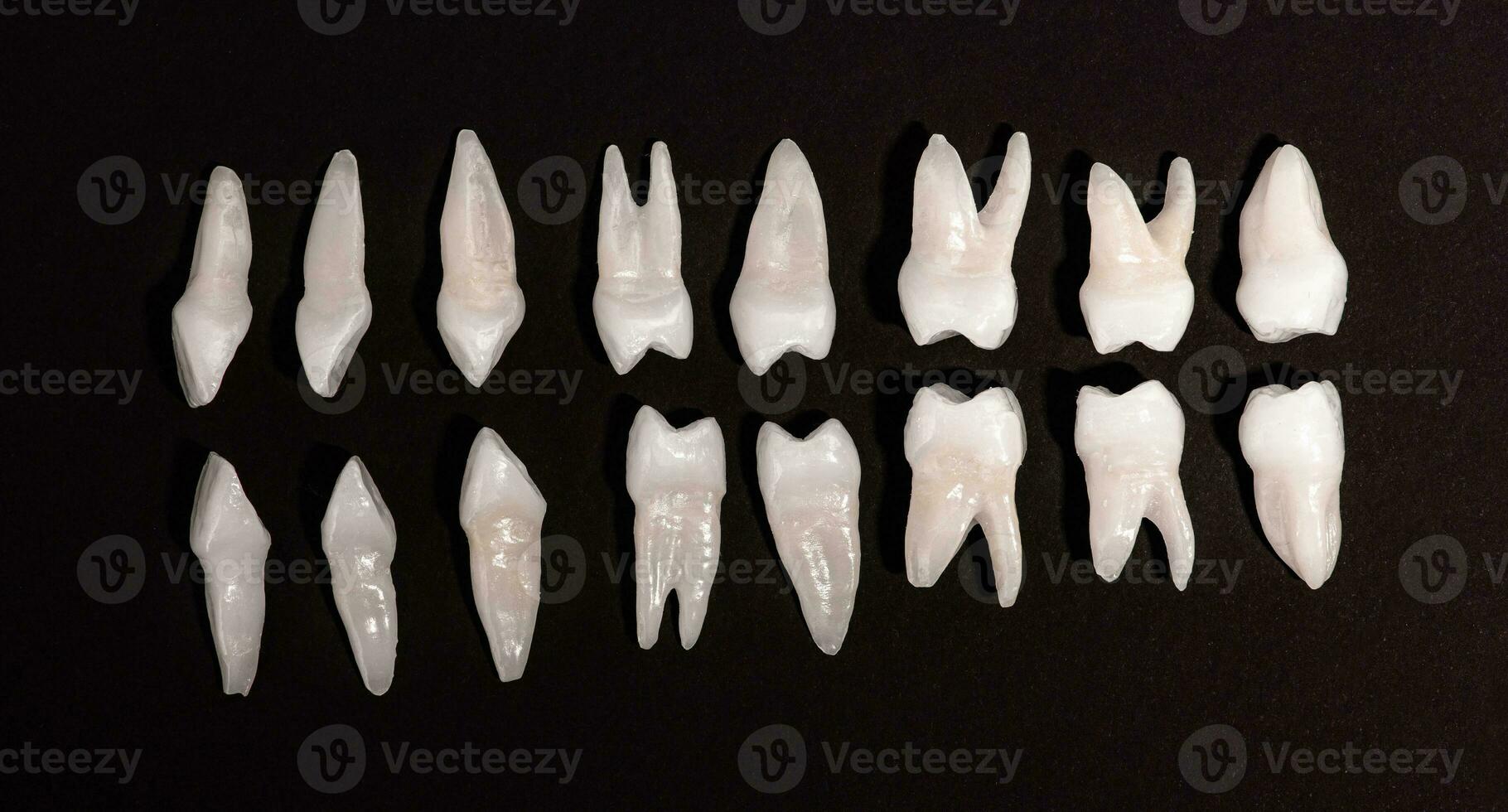 protético odontologia branco dentes em Preto fundo oral dental higiene dental saúde conceito oral Cuidado dentes restauração topo visualizar. foto