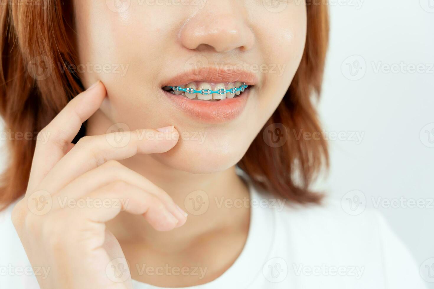 tratamento. dental Cuidado. lindo ásia mulher saudável sorriso.metal colchetes em dentes. jovem fêmea sorrir com suspensórios e mostrar lindo do dentes, Cuidado depois de aparelho ortodôntico, confiante dentro ortodontia foto