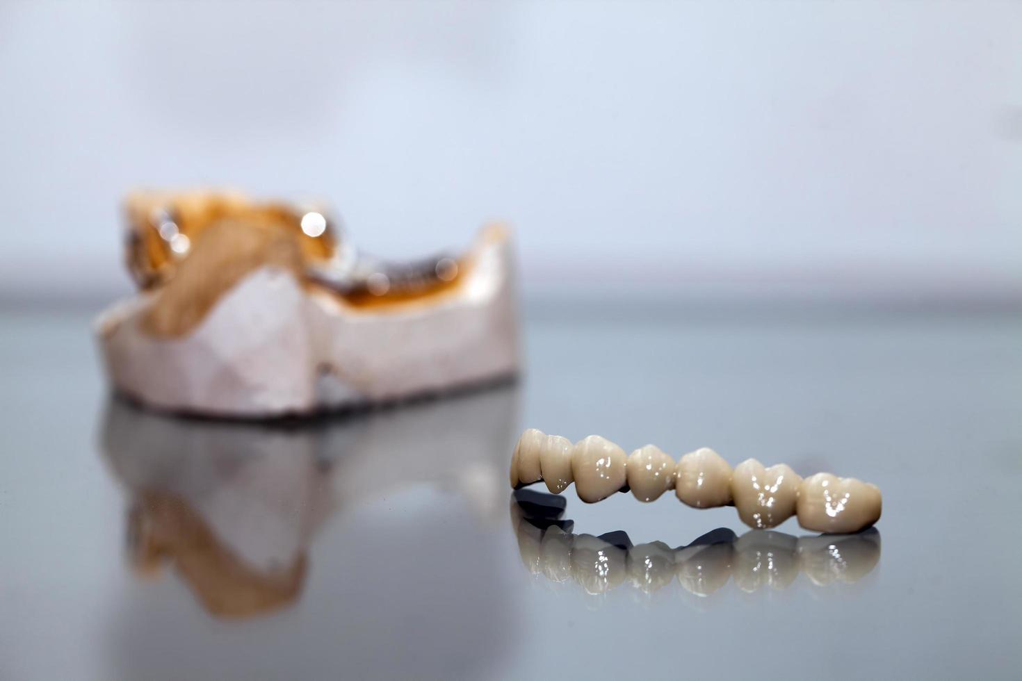 Placa dentária de porcelana de zircônio em loja de dentista foto