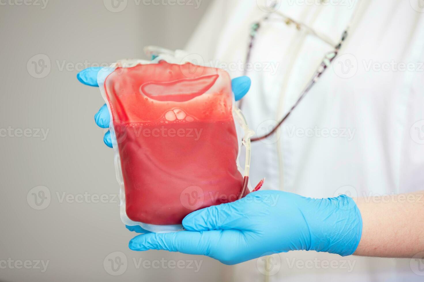 sangue plasma dentro a Centro do transfusiologia e doação. fechar acima a sangue saco dentro a laboratório dentro a mãos. foto