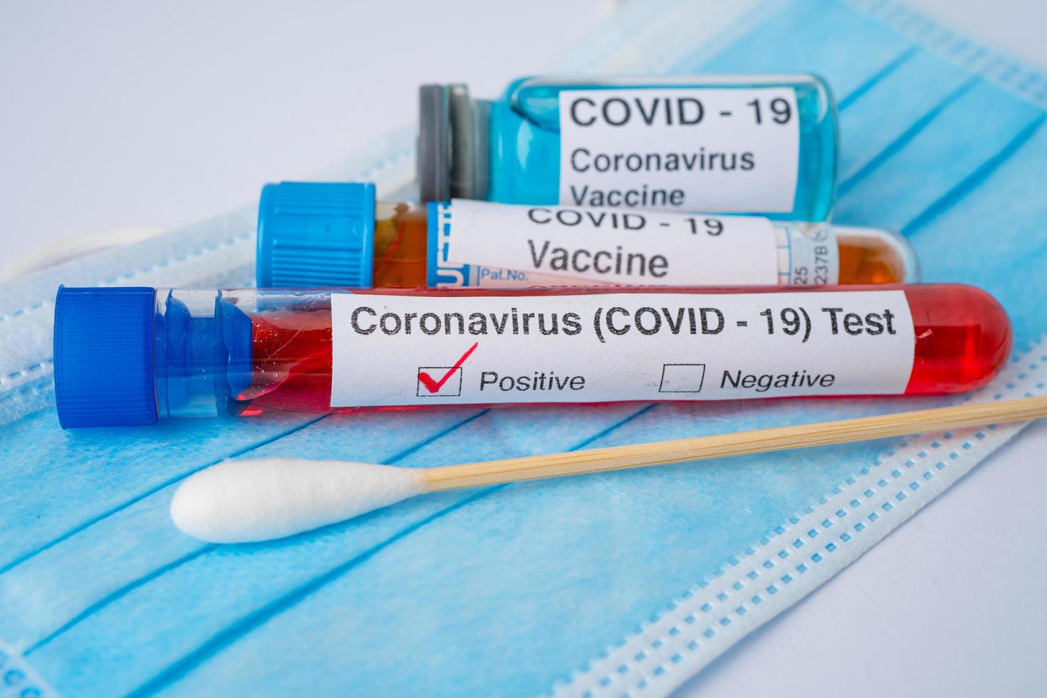 amostra de infecção de sangue positiva em tubo de ensaio para coronavírus covid-19 foto