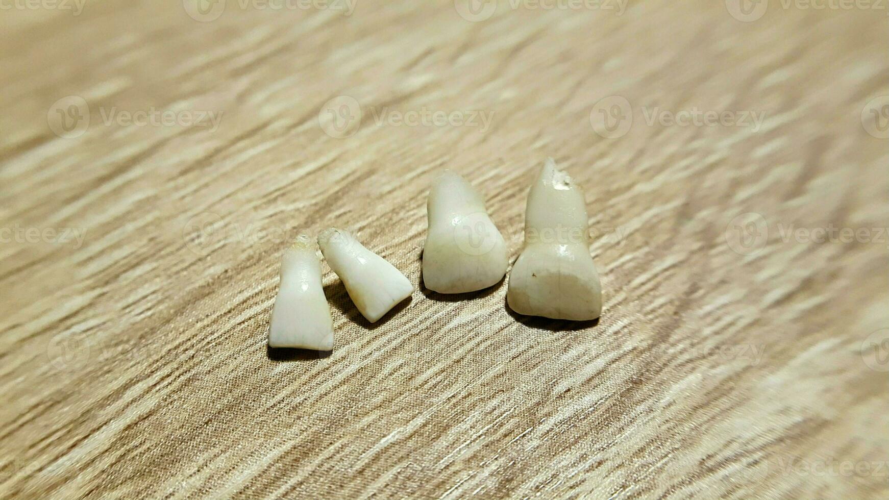 fechar acima a pequeno caído leite dentes em a mesa. dente fada. infância cuidados de saúde conceito. foto