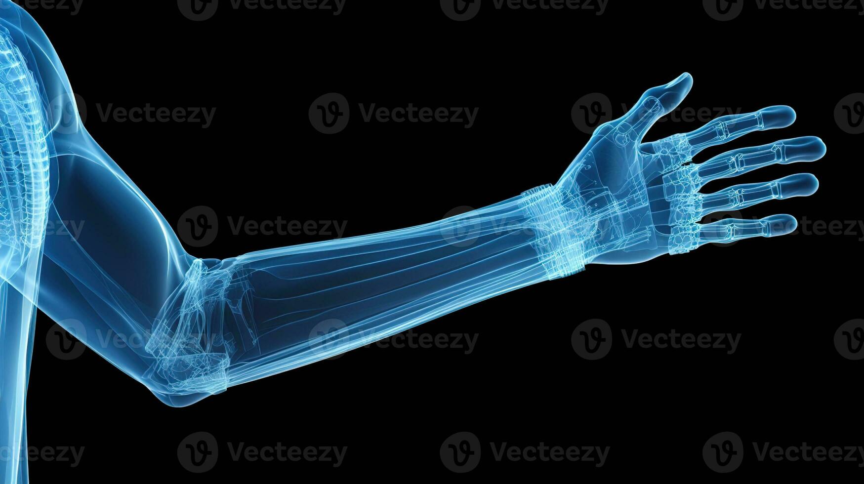 ortopédico excelência, detalhado raio X do uma masculino humano braço dentro azul tons em uma Preto fundo - ideal para preciso médico imagem e diagnóstico, ai generativo foto