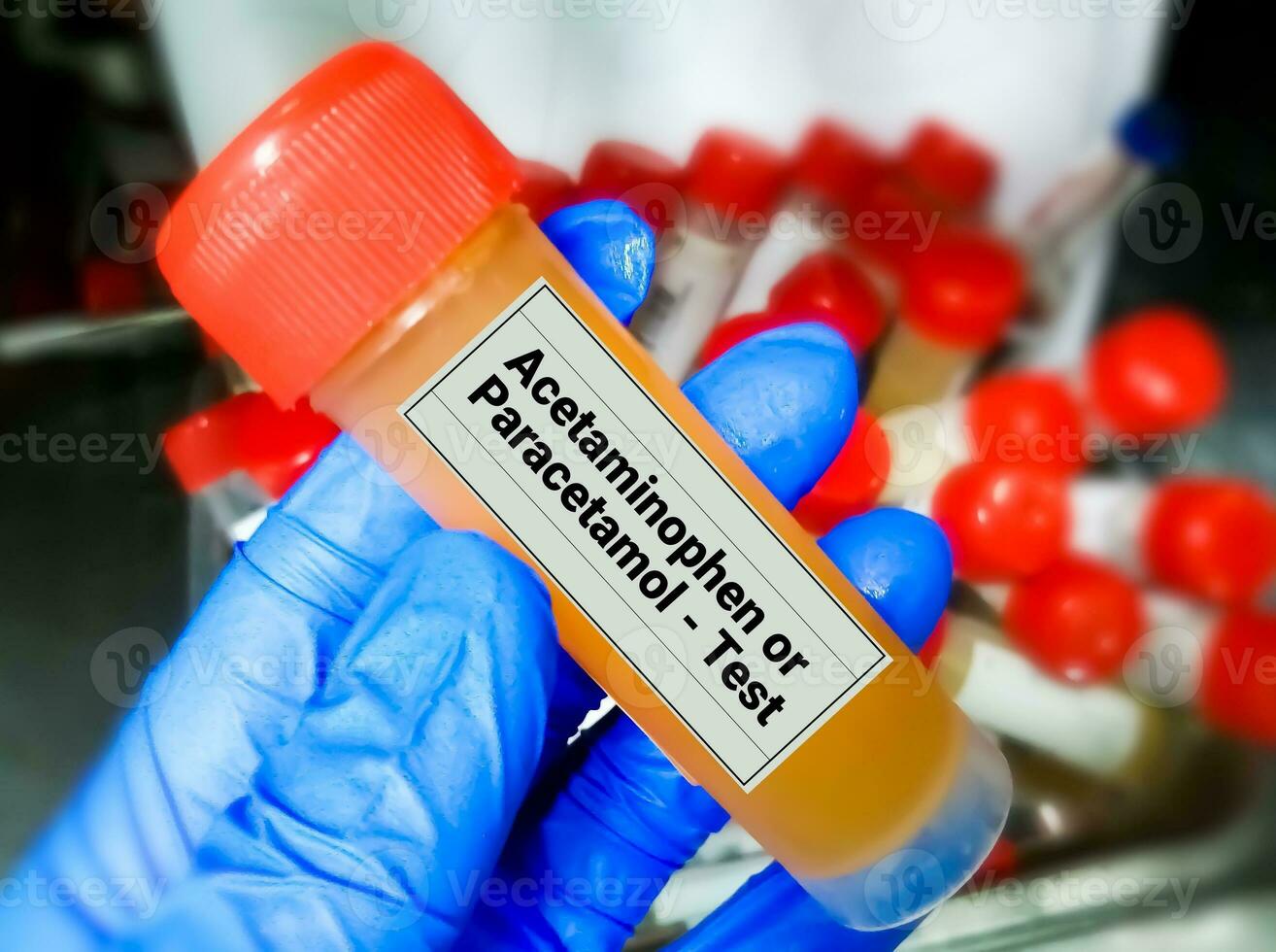urina amostra para acetaminofeno ou paracetamol droga teste, foto