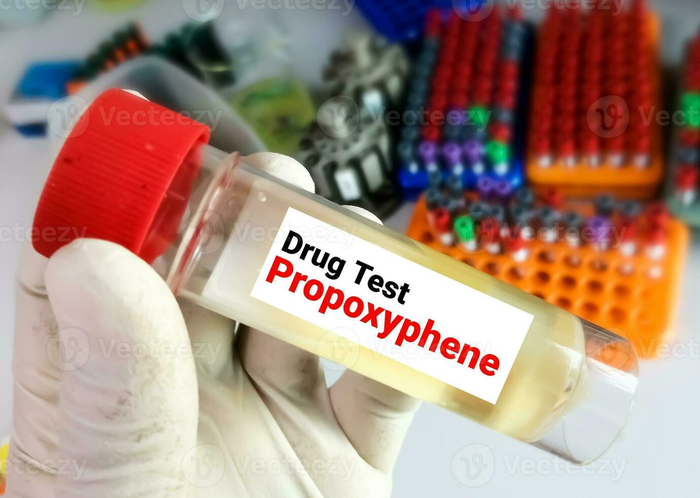urina amostra para propoxifeno droga teste, álcool vício. foto