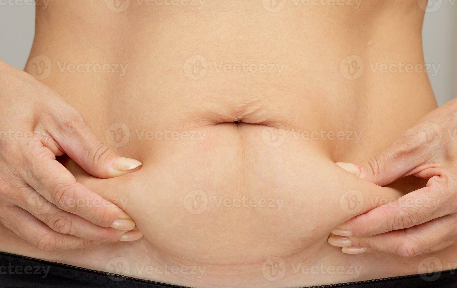 mãos em barriga pressionado pele para mostrar flacidez pele depois de dieta e esticam marcas depois de gravidez foto