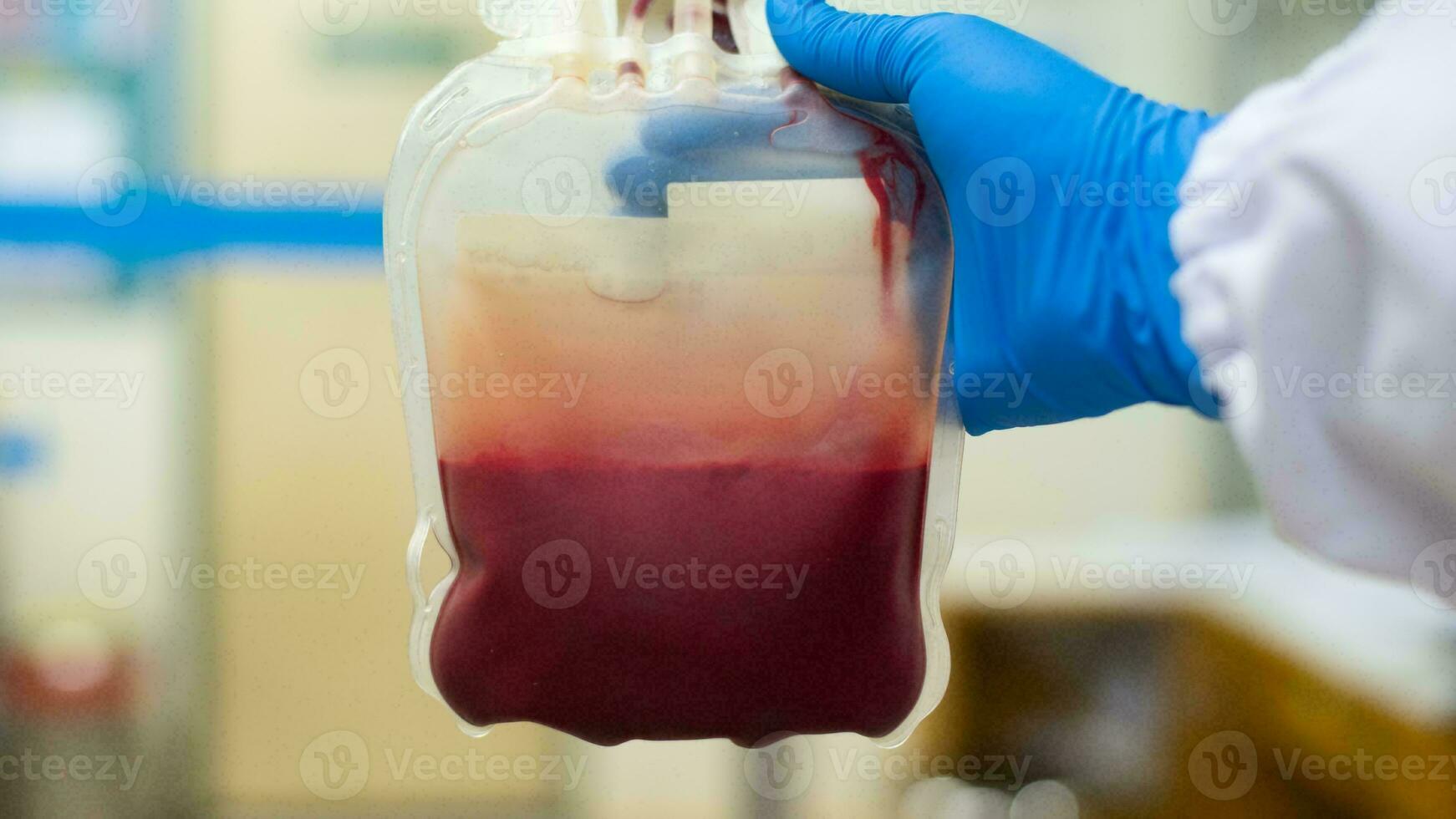 sangue saco doação Centro, transfusão conceito, poupança de vida hospital procedimento, médico fornecem dentro emergência situação foto