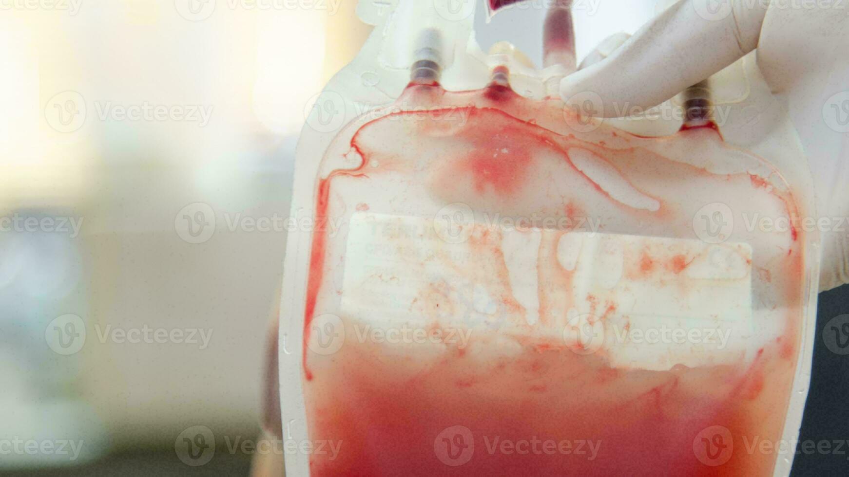 sangue saco doação Centro, transfusão conceito, poupança de vida hospital procedimento, médico fornecem dentro emergência situação foto