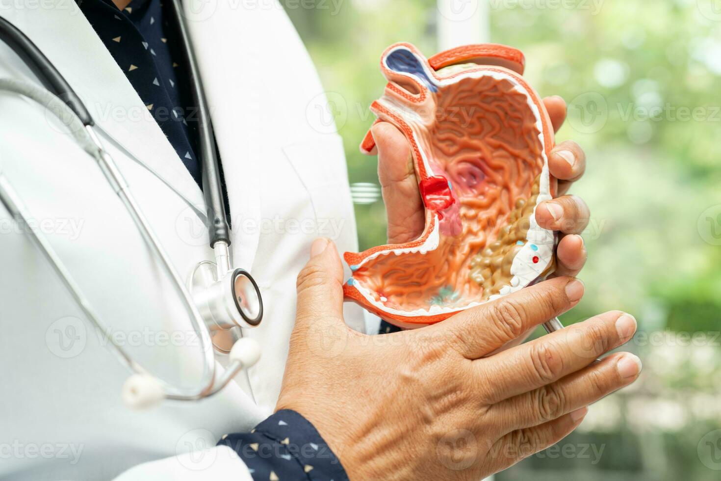 estômago doença, médico segurando anatomia modelo para estude diagnóstico e tratamento dentro hospital. foto