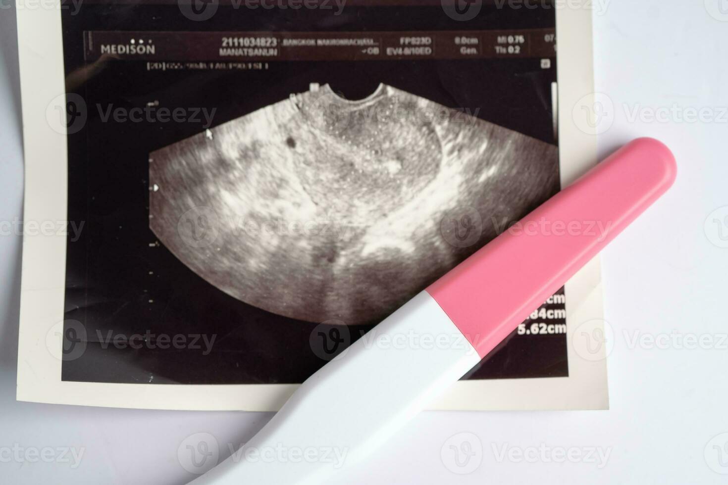 gravidez teste com ultrassom Varredura do bebê útero, contracepção saúde e remédio. foto