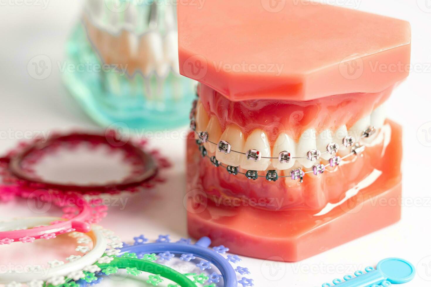 ortodôntico ligaduras argolas e laços, elástico borracha bandas em ortodôntico aparelho ortodôntico, modelo para dentista estudando sobre odontologia. foto