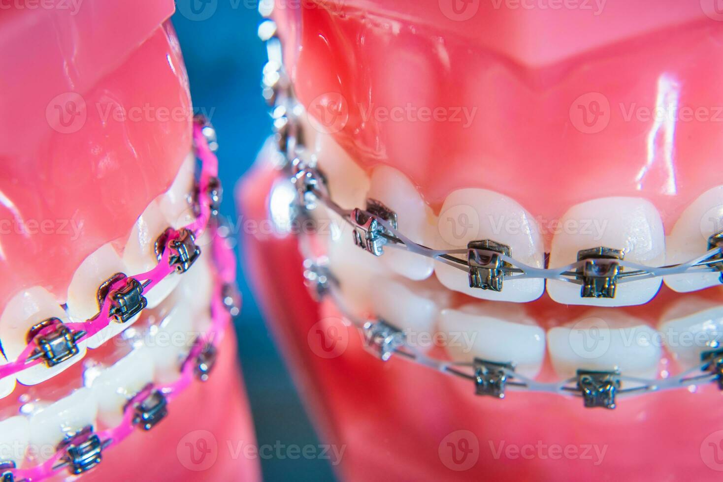 a suspensórios estão colocada em a dentes dentro a artificial mandíbula. macro fotografia foto