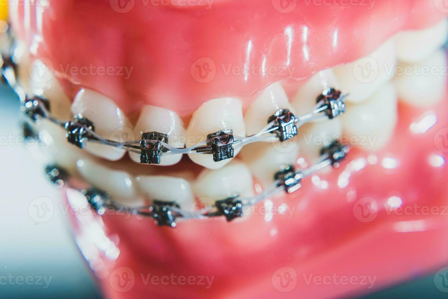 a suspensórios estão colocada em a dentes dentro a artificial mandíbula. macro fotografia foto