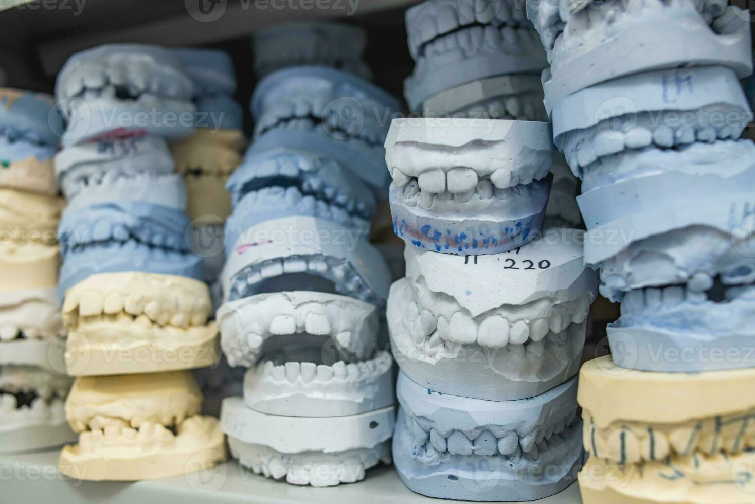 armazém do gesso modelos do humano mandíbulas dentro a ortodôntico clínica. ao controle e diagnóstico dental elencos para alinhadores. foto