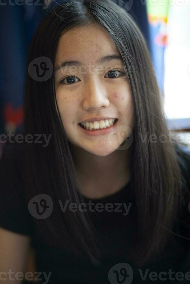 acne face do ásia adolescente cheio de dentes sorridente foto
