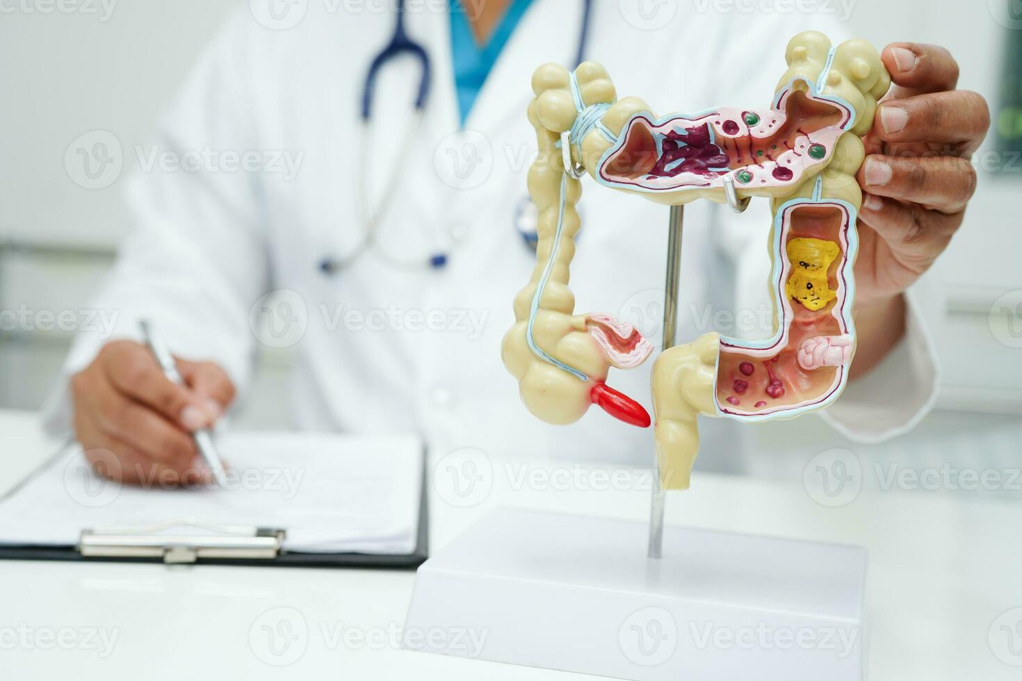 intestino, médico segurando anatomia modelo para estude diagnóstico e tratamento dentro hospital. foto